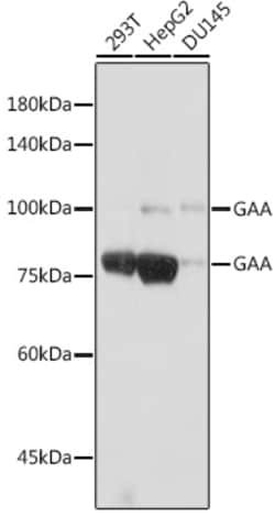 Invitrogen GAA Recombinant Rabbit Monoclonal Antibody (5L2L10) 100 &mu;L;