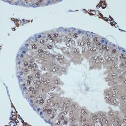 Invitrogen RANBP9 Recombinant Rabbit Monoclonal Antibody (4P10V6) 100 &mu;L;