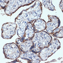 Invitrogen PDI Recombinant Rabbit Monoclonal Antibody (10U5D5) 100 &mu;L;