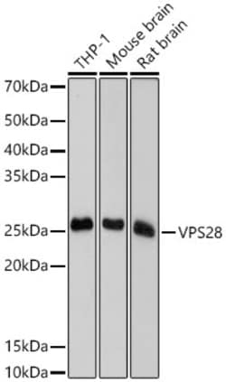 Invitrogen VPS28 Recombinant Rabbit Monoclonal Antibody (4F8M0) 100 &mu;L | Buy Online | Invitrogen&trade; | Fisher Scientific