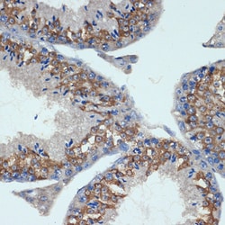 Invitrogen CHMP2B Recombinant Rabbit Monoclonal Antibody (3L9O5) 100 &mu;L;