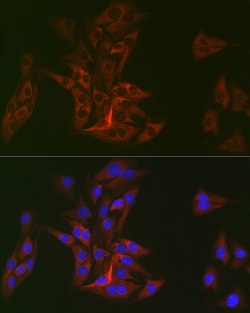 Invitrogen DOK1 Recombinant Rabbit Monoclonal Antibody (6U4U9) 100 &mu;L;