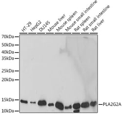 Invitrogen PLA2G2A Recombinant Rabbit Monoclonal Antibody (3X9F5) 100 &mu;L | Buy Online | Invitrogen&trade; | Fisher Scientific