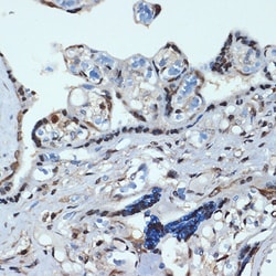 Invitrogen HOXA9 Recombinant Rabbit Monoclonal Antibody (9X1L6) 100 &mu;L;