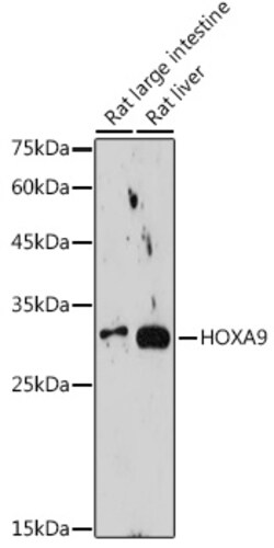 Invitrogen HOXA9 Recombinant Rabbit Monoclonal Antibody (9X1L6) 100 &mu;L;