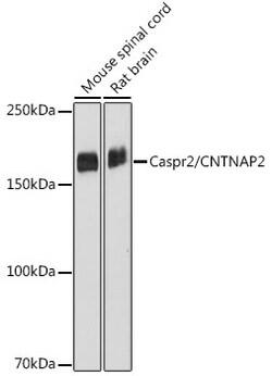 Invitrogen Caspr2 Recombinant Rabbit Monoclonal Antibody (2H2I5) 100 &mu;L | Buy Online | Invitrogen&trade; | Fisher Scientific