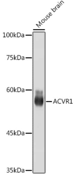 Invitrogen ACVR1 Recombinant Rabbit Monoclonal Antibody (1J7G4) 100 &mu;L | Buy Online | Invitrogen&trade; | Fisher Scientific