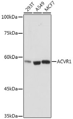 Invitrogen ACVR1 Recombinant Rabbit Monoclonal Antibody (1J7G4) 100 &mu;L | Buy Online | Invitrogen&trade; | Fisher Scientific