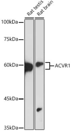Invitrogen ACVR1 Recombinant Rabbit Monoclonal Antibody (1J7G4) 100 &mu;L | Buy Online | Invitrogen&trade; | Fisher Scientific