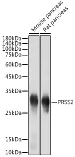 Invitrogen Trypsin 2 Recombinant Rabbit Monoclonal Antibody (3D9O7) 100