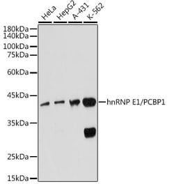 Invitrogen PCBP1 Recombinant Rabbit Monoclonal Antibody (7M1K0) 100 &mu;L | Buy Online | Invitrogen&trade; | Fisher Scientific