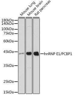 Invitrogen PCBP1 Recombinant Rabbit Monoclonal Antibody (7M1K0) 100 &mu;L | Buy Online | Invitrogen&trade; | Fisher Scientific
