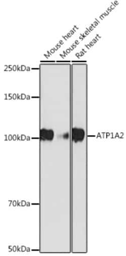 Invitrogen ATP1A2 Recombinant Rabbit Monoclonal Antibody (5T3O4) 100 &mu;L | Buy Online | Invitrogen&trade; | Fisher Scientific