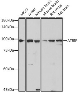 Invitrogen ATRIP Recombinant Rabbit Monoclonal Antibody (2C4B6) 100 &mu;L;