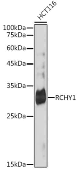 Invitrogen Pirh2 Recombinant Rabbit Monoclonal Antibody (4Q5H9) 100 &mu;L;