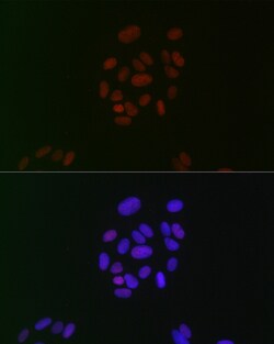 Invitrogen CIRBP Recombinant Rabbit Monoclonal Antibody (3V9S7) 100 &mu;L;