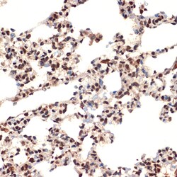 Invitrogen CIRBP Recombinant Rabbit Monoclonal Antibody (3V9S7) 100 &mu;L;