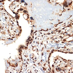 Invitrogen CIRBP Recombinant Rabbit Monoclonal Antibody (3V9S7) 100 &mu;L;