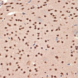 Invitrogen CIRBP Recombinant Rabbit Monoclonal Antibody (3V9S7) 100 &mu;L;