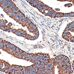 BCL2L14 Recombinant Rabbit Monoclonal Antibody (ARC2474), Invitrogen 100