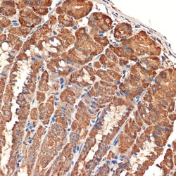 BCL2L14 Recombinant Rabbit Monoclonal Antibody (ARC2474), Invitrogen 100