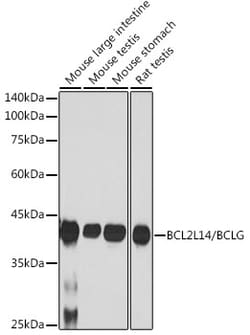 BCL2L14 Recombinant Rabbit Monoclonal Antibody (ARC2474), Invitrogen 100