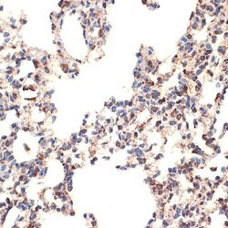 BCL2L14 Recombinant Rabbit Monoclonal Antibody (ARC2474), Invitrogen 100