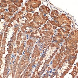 BCL2L14 Recombinant Rabbit Monoclonal Antibody (ARC2474), Invitrogen 100