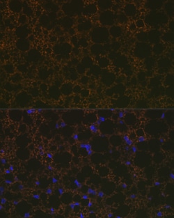 Invitrogen UCP1/UCP3 Recombinant Rabbit Monoclonal Antibody (0S10O10) 100