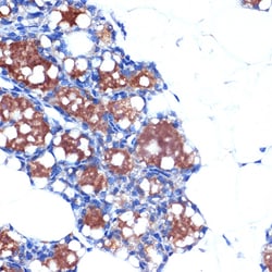 Invitrogen UCP1/UCP3 Recombinant Rabbit Monoclonal Antibody (0S10O10) 100