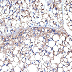 Invitrogen UCP1/UCP3 Recombinant Rabbit Monoclonal Antibody (0S10O10) 100