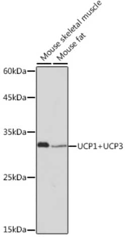 Invitrogen UCP1/UCP3 Recombinant Rabbit Monoclonal Antibody (0S10O10) 100