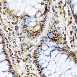 Invitrogen COPS3 Recombinant Rabbit Monoclonal Antibody (7V1L8) 100 &mu;L;