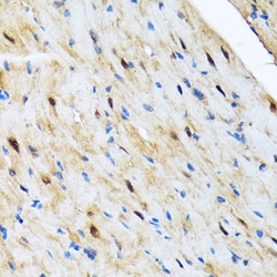Invitrogen COPS3 Recombinant Rabbit Monoclonal Antibody (7V1L8) 100 &mu;L;