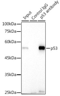 Invitrogen p53 Recombinant Rabbit Monoclonal Antibody (9D6F7) 100 &mu;L | Buy Online | Invitrogen&trade; | Fisher Scientific