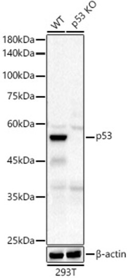 Invitrogen p53 Recombinant Rabbit Monoclonal Antibody (9D6F7) 100 &mu;L | Buy Online | Invitrogen&trade; | Fisher Scientific