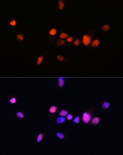 Androgen Receptor Recombinant Rabbit Monoclonal Antibody (10G4D3) 100 &mu;L:Antibodies,