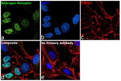 Androgen Receptor Recombinant Rabbit Monoclonal Antibody (10G4D3) 100 &mu;L:Antibodies,