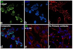 Androgen Receptor Recombinant Rabbit Monoclonal Antibody (10G4D3) 100 &mu;L:Antibodies,