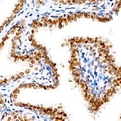 Androgen Receptor Recombinant Rabbit Monoclonal Antibody (10G4D3) 100 &mu;L:Antibodies,