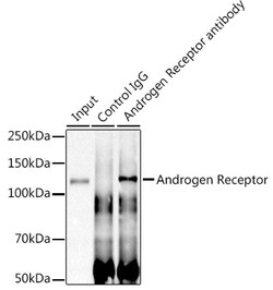 Androgen Receptor Recombinant Rabbit Monoclonal Antibody (10G4D3) 100 &mu;L:Antibodies,