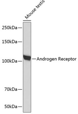 Androgen Receptor Recombinant Rabbit Monoclonal Antibody (10G4D3) 100 &mu;L:Antibodies,