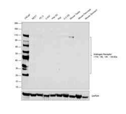 Androgen Receptor Recombinant Rabbit Monoclonal Antibody (10G4D3) 100 &mu;L:Antibodies,