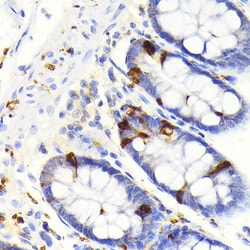 Invitrogen SCGN Recombinant Rabbit Monoclonal Antibody (9K8H9) 100 &mu;L;