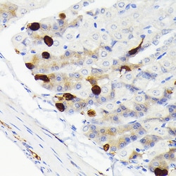 Invitrogen SCGN Recombinant Rabbit Monoclonal Antibody (9K8H9) 100 &mu;L;