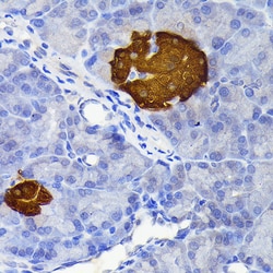 Invitrogen SCGN Recombinant Rabbit Monoclonal Antibody (9K8H9) 100 &mu;L;