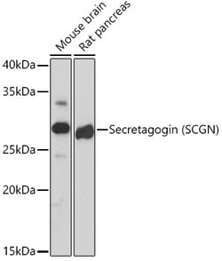 Invitrogen SCGN Recombinant Rabbit Monoclonal Antibody (9K8H9) 100 &mu;L;