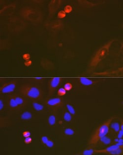 Invitrogen TACC3 Recombinant Rabbit Monoclonal Antibody (7S7L2) 100 &mu;L | Buy Online | Invitrogen&trade; | Fisher Scientific