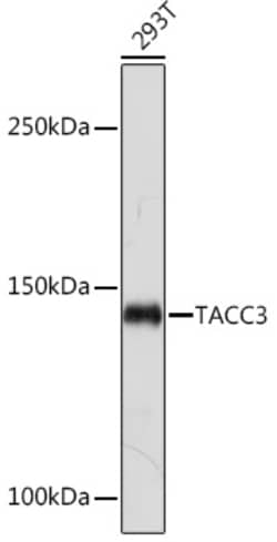 Invitrogen TACC3 Recombinant Rabbit Monoclonal Antibody (7S7L2) 100 &mu;L | Buy Online | Invitrogen&trade; | Fisher Scientific