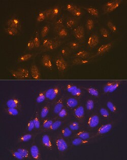 Invitrogen TGN46 Recombinant Rabbit Monoclonal Antibody (9G5X6) 100 &mu;L;